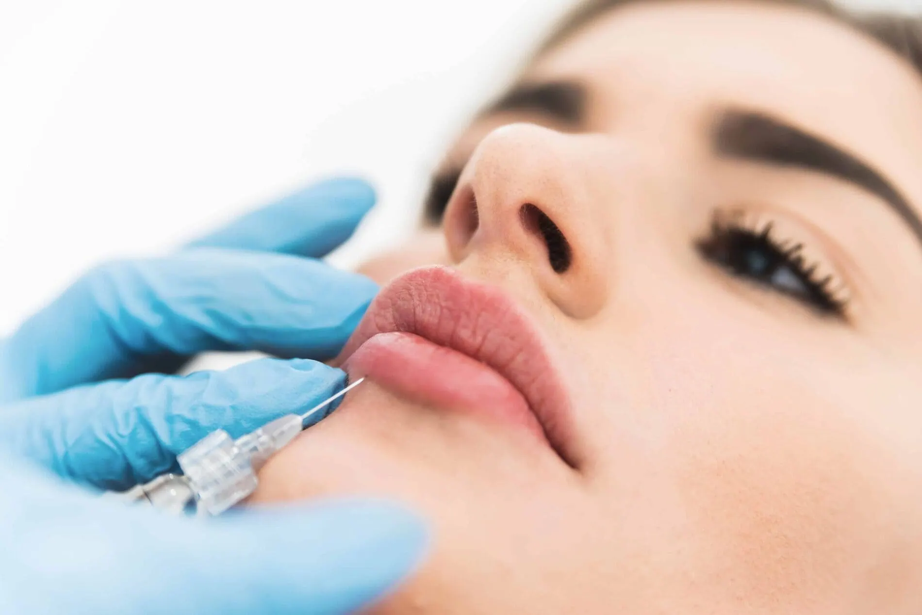 Lip Filler Treatment | Tu Beauty Med Spa in Linwood, New Jersey