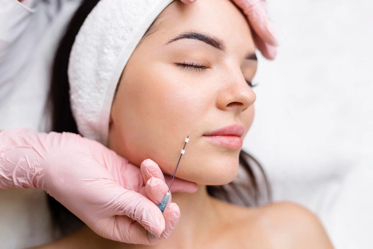 PDO thread lift treatment for facial lifting at Tú Beauty Med Spa in Linwood NJ