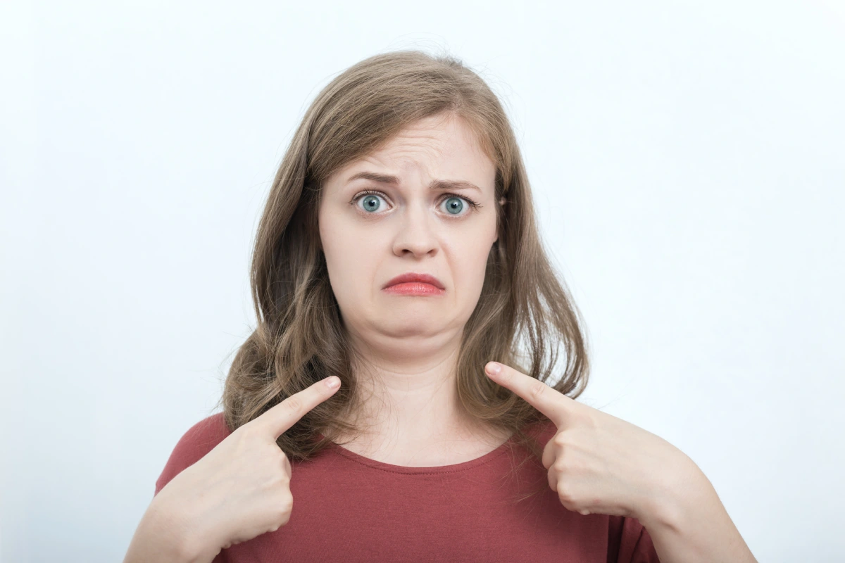 Woman concerned about double chin and submental fat before Kybella treatment.
